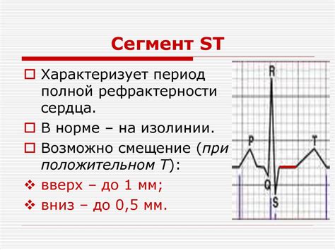 ЭКГ в норме и патологии - презентация онлайн