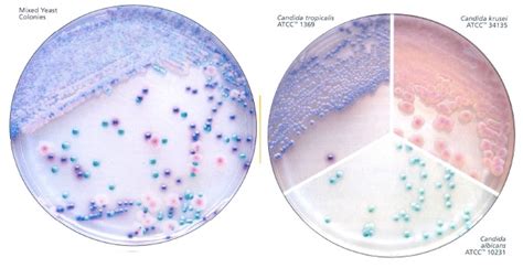 Chromagar Candida Interlab