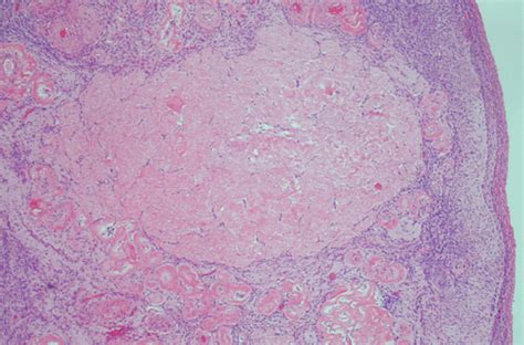 Normal Histology