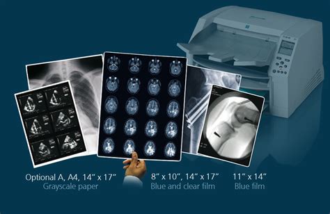 All-in-one imager / film printer for X-ray films without chemistry