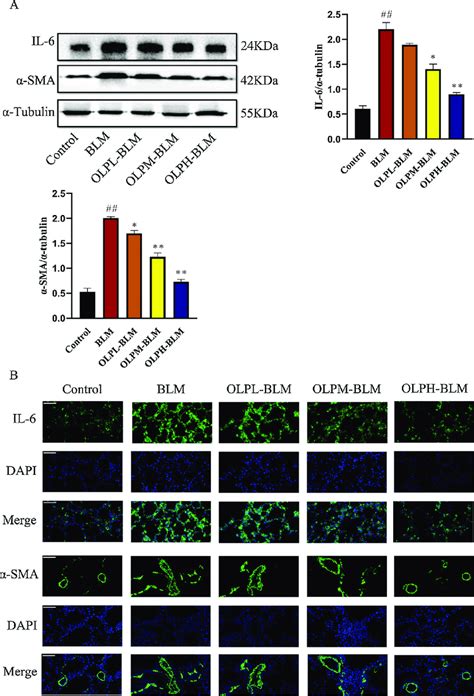 Expression levels of IL 6 and α SMA proteins A Protein expressions