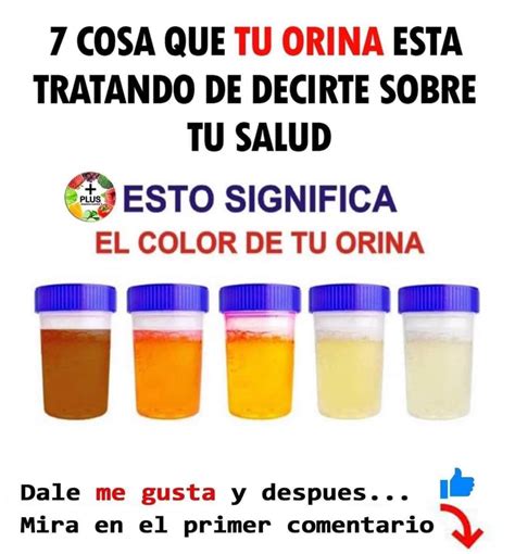 El color de su orina indica cómo está su salud aquí le mostramos su