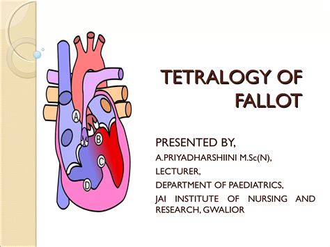 Tetralogy Of Fallot Ppt