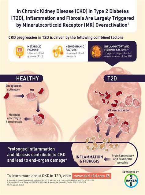 Edgar V Lerma On Twitter Ckd In Type Diabetes Role Of