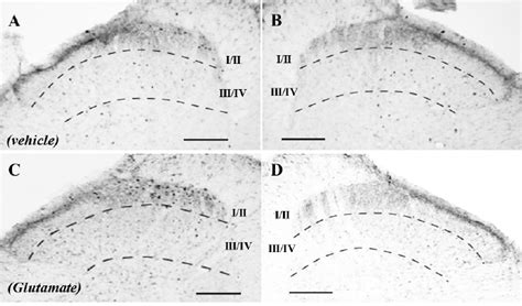 Photomicrographs Showing C Fos Positive Neurons In The Dorsal Horn Of