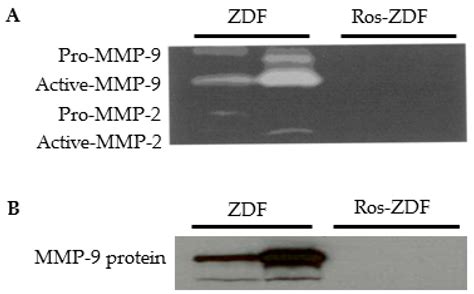 Ijms Free Full Text Endocytosis Of Albumin Induces Matrix