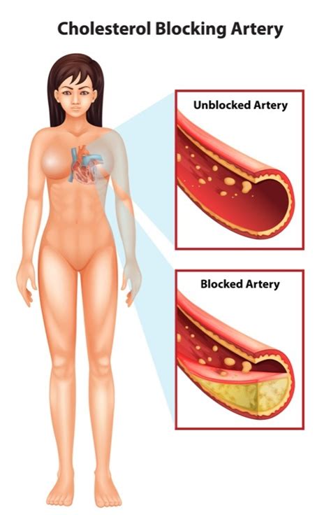 Have 4 Spoons Of This In The Morning And No More Pressure Cholesterol