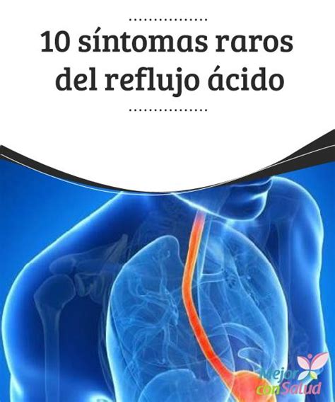 10 síntomas que muchos desconocen del reflujo ácido Reflujo Reflujo