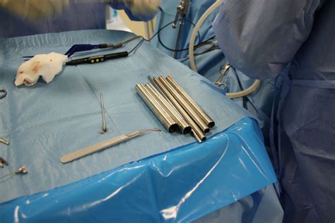 METRx Micro Endoscopic Spine Surgery