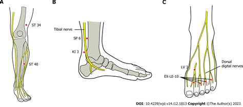 Acupuncture In Diabetic Peripheral Neuropathy Neurological Outcomes Of