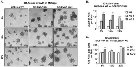 Cancers Free Full Text Selenof Controls Proliferation And Cell