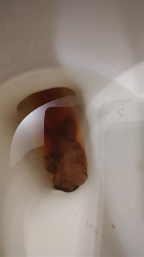 Almost Every Morning I Gotta Poop 💩 Rratemypoo