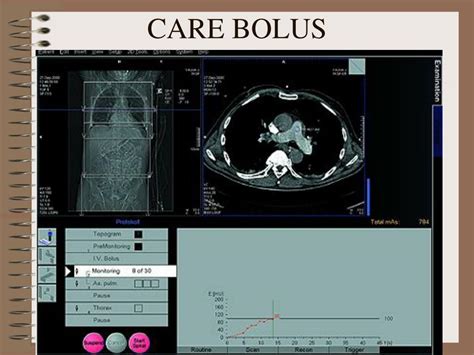 Ppt Ct Angiography Powerpoint Presentation Free Download Id443533