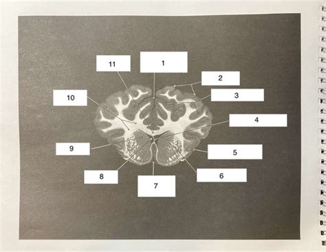 Coronal View (Cross Sections) STRUCTURE Flashcards | Quizlet 