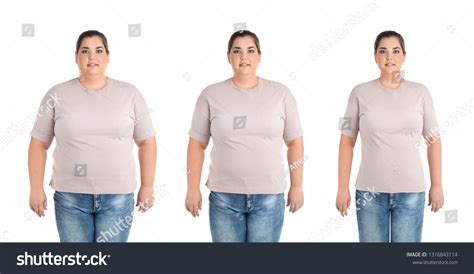 7,334 Before And After Obesity Images, Stock Photos & Vectors ...