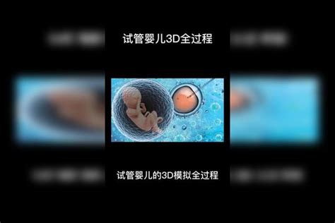 试管婴儿3d全过程试管婴儿 试管助孕 接一切好孕