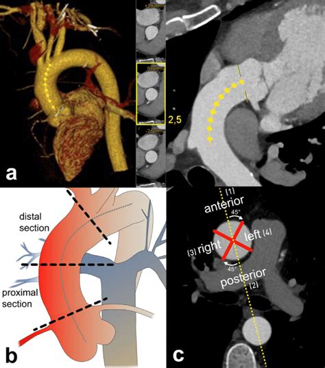 Ascending And Descending Aorta Anatomy