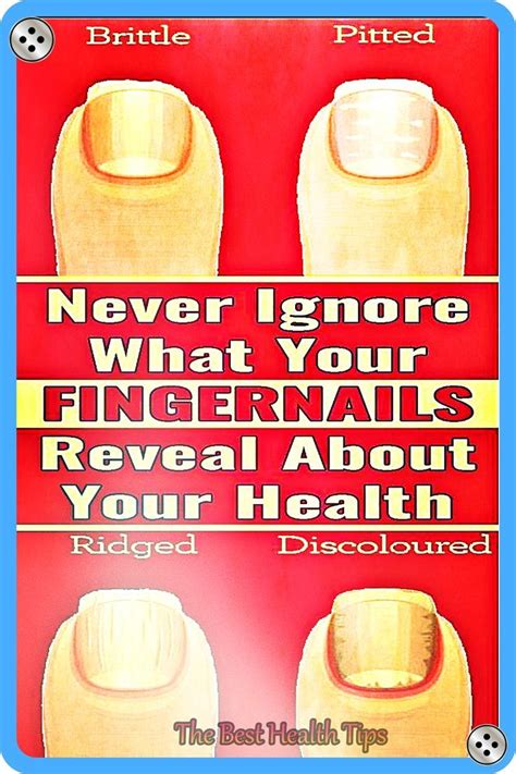 8 Important Signs Your Fingernails Can Tell About Your Health Artofit