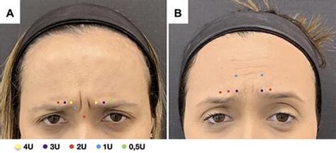 Full Article The One21 Technique An Individualized Treatment For