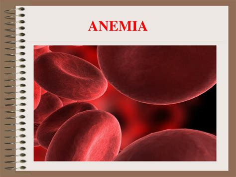 Ppt Anemia Powerpoint Presentation Free Download Id 3557169