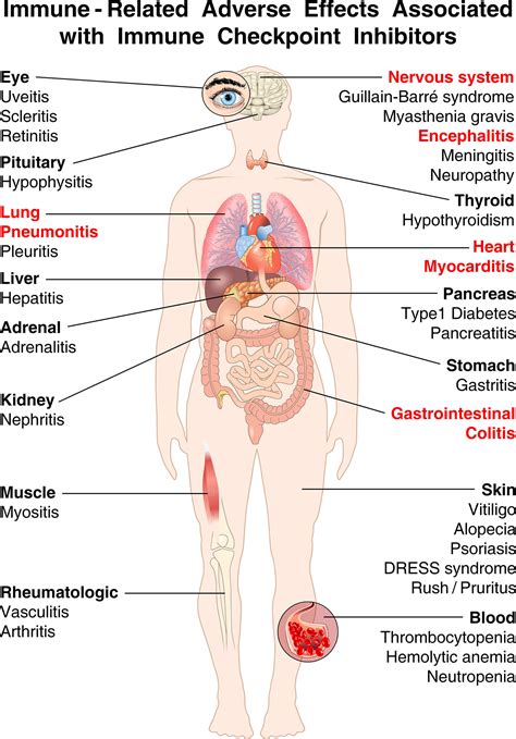 Frontiers Holistic Approach To Immune Checkpoint Inhibitor Related Adverse Events