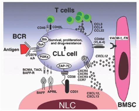 Chronic Lymphocytic Leukemia Oncohema Key