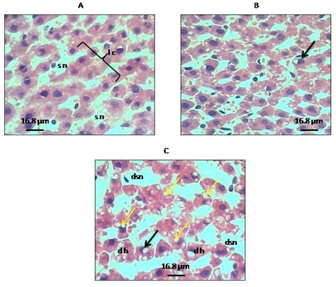 A C Photomicrographs Of H And E Stained Liver Sections Download Scientific Diagram