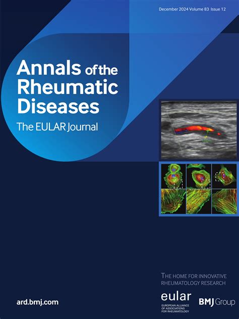 Systemic Juvenile Idiopathic Arthritis And Adult Onset Stills Disease