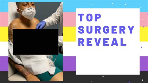 Top Surgery Reveal Ftm Youtube