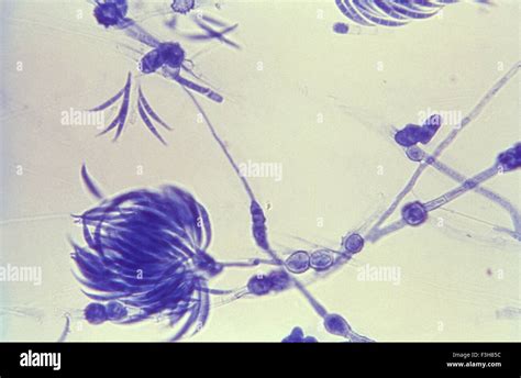 Microconidia Of Fusarium