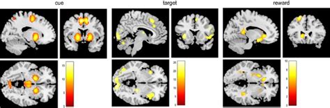 Serotonergic Modulation Of ‘waiting Impulsivity Is Mediated By The