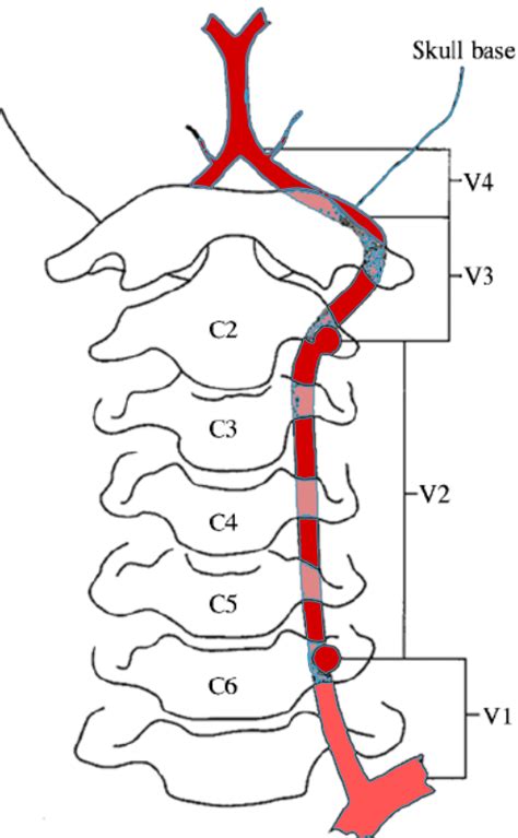 WHAT EVIDENCE CAN CASE REPORTS ON SPINE MANIPULATIVE THERAPY AND