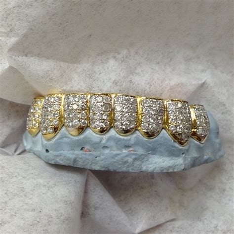 Chief Keefs New 84 Carat Diamond Chain And Iced Out Gold Grillz From Tv