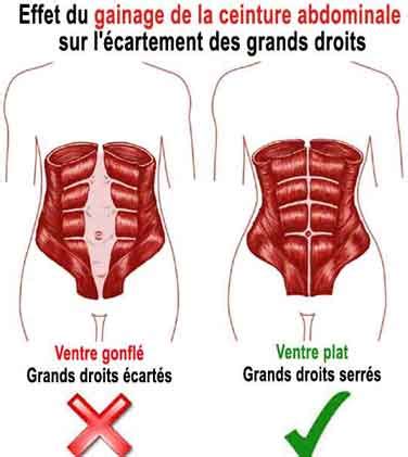 Gainage Exercices Pour Renforcer La Sangle Abdominale