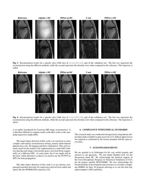 Density Compensated Unrolled Networks For Non Cartesian Mri