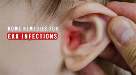 Home Remedies For Ear Infections Healthtostyle