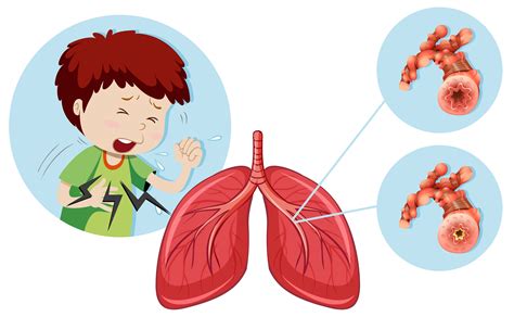 A Man Having Chronic Obstructive Pulmonary Disease 303710 Vector Art At