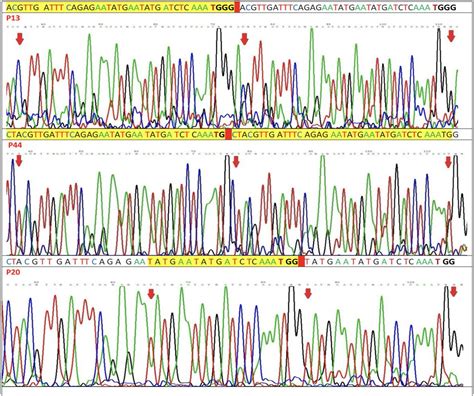 Evaluating The Clinical Significance Of Flt Mutation Status In Syrian