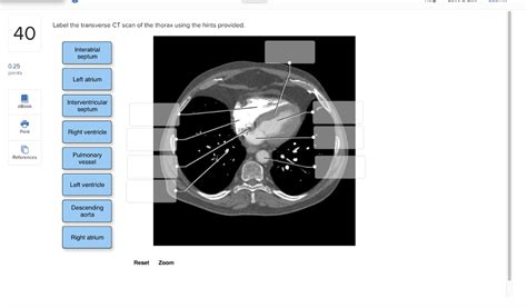 Solved Label The Transverse Ct Scan Of The Thorax Using The