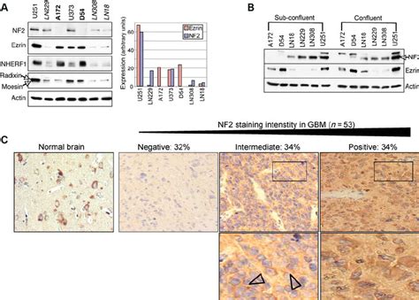 Nf2 And Ezrin Expression Patterns In Gbm A Western Blot Analysis Download Scientific Diagram