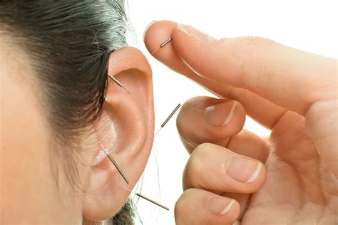 Auricular Therapy Acupuncture Wellbeing