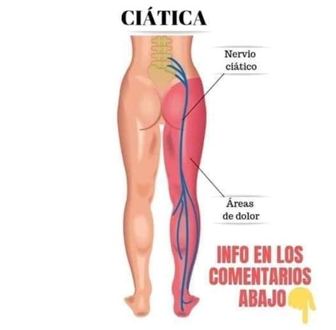 Ejercicios Para DESBLOQUEAR El Nervio Ciatico La Cura Natural