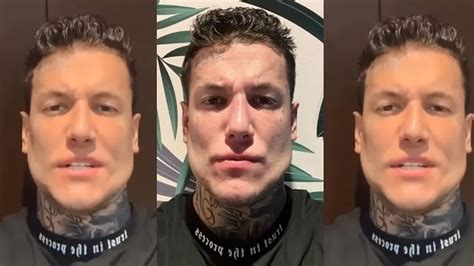 La nueva foto de Alex Caniggia tras operarse la mandíbula Cada día