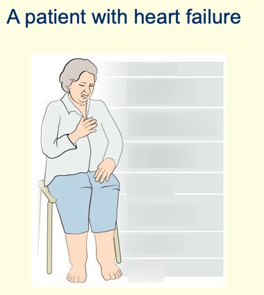 Symptoms of Heart Failure Diagram | Quizlet