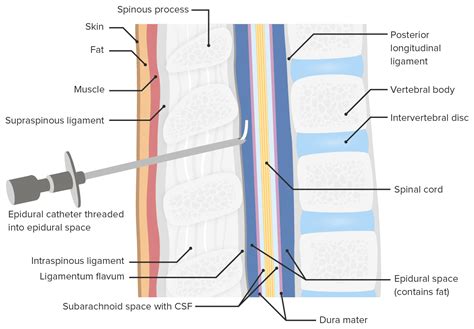 Epidural Catheter Depth Markings