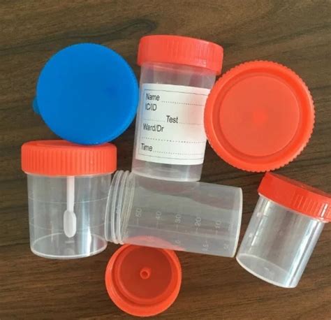 Types Of Specimen Containers At Samantha Kaye Blog