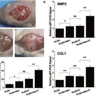 Scaffolds Combine Aker And Human Ipscs Promote The Healing Of Skull