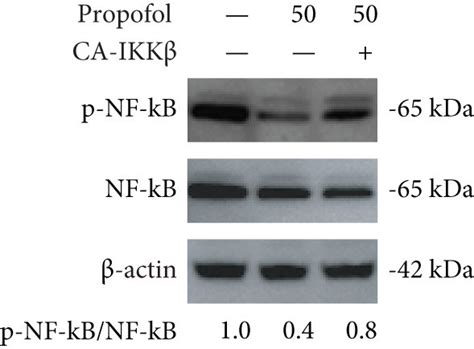 Propofol Attenuates Nf κb Signaling To Inhibit Microglial Activation