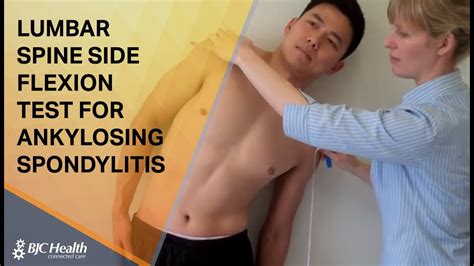 Lumbar Spine Side Flexion Test For Ankylosing Spondylitis Youtube