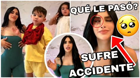 KIMBERLY LOAIZA SUFRE ACCIDENTE Y ALBOROTA A TODOS YouTube